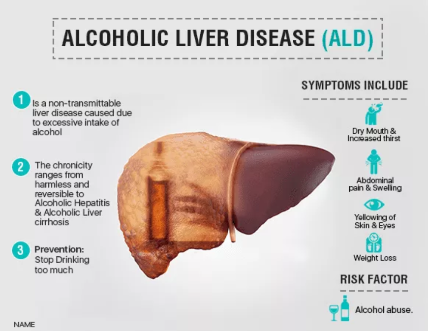 Liver Cirrhosis Symptoms