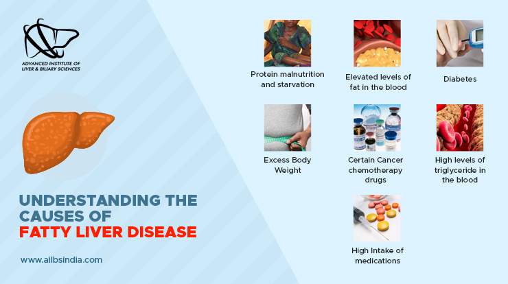 Everything You Need To Know About Fatty Liver Diseases - Ailbs India