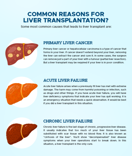 Cost of Liver Transplant in India | Success Rate & Treatment - AILBS India