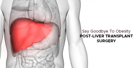 How To Prevent Obesity After Liver Transplant?