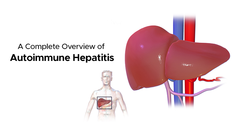 what-is-autoimmune-hepatitis-symptoms-and-treatment-ailbs-india