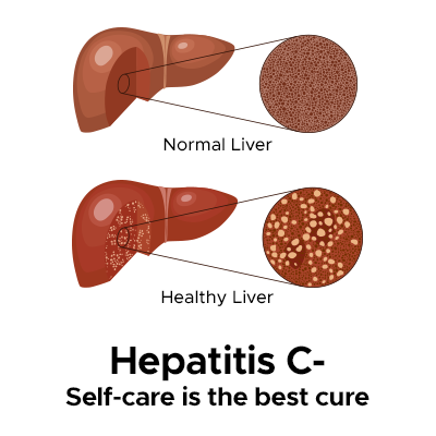 Hepatitis C: Self-Care Tips To Live Better