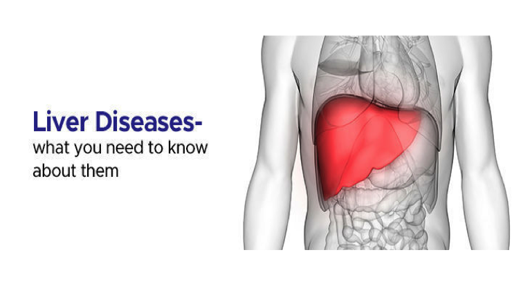 Liver Diseases: Some common types and Symptoms - AILBS India