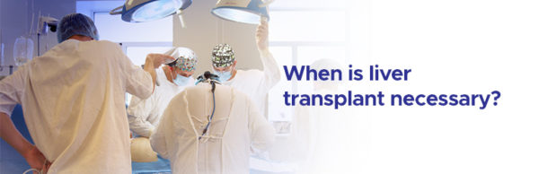 When You Need Liver Transplant Surgery Ailbs India 5183