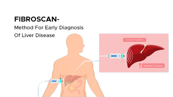 Fibroscan - Method For Early Diagnosis Of Liver Disease - AILBS India