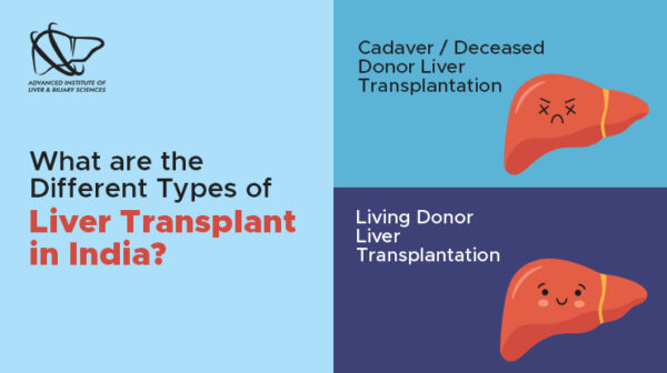 Does India's Liver Transplant Setup Really Favour Foreigners? - AILBS India