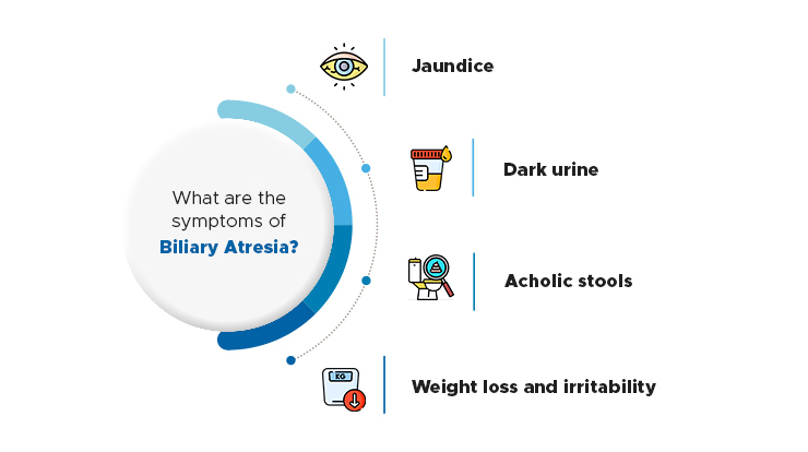 what are the symptoms of biliary atresia